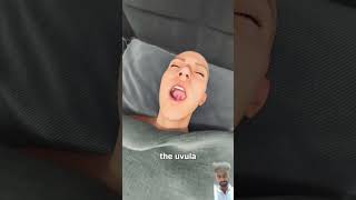 Removing Your Uvula 🤔 doctor dentist zackkingmagic zackdfilms zack shortsfeed shortsviral [upl. by Reham]