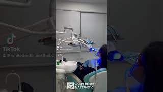 Pastrimi i gurezave dhe zbardhimi i dhembeve me 50 ulje dentis laserhairremoval [upl. by Vachel229]