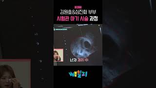 김원효amp심진화 부부의 눈물의 시험관 시술 과정 大공개 아빠본색 [upl. by Laband]