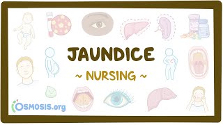 Jaundice Clinical Nursing Care [upl. by Erdna]