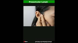 Preauricular Lymph Nodes What to KnowShorts [upl. by Aras]