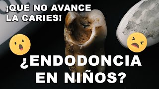 😱 ¿¿¿ENDODONCIA en Niños  Pulpotomía o pulpectomía [upl. by Debarath296]