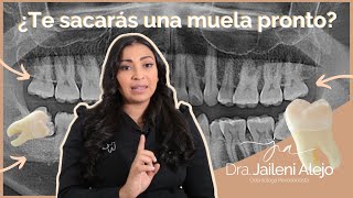 EXTRACCIÓN DENTAL ¿QUÉ SENTIRÁS TE EXPLICO PASO A PASO odontologia [upl. by Maud749]