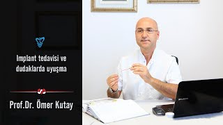 İmplant Tedavisi Ve Dudaklarda Uyuşma [upl. by Richer647]