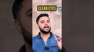 Puffy Eyes Eye Bags amp Dark Circles Treatment Solution for Brighter Eyes [upl. by Binni]