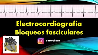 🏅 ELECTROCARDIOGRAMA 9 🫀 BLOQUEOS FASCICULARES [upl. by Leinahtam]