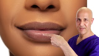 How to Plump Your Lips Naturally Dr Mandell [upl. by Cudlip]