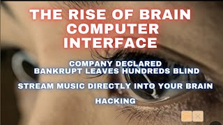 The Rise of Brain Computer interface Bankrupt company leaves hundreds blind [upl. by Hluchy]