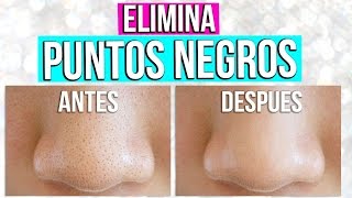 ELIMINA PUNTOS NEGROS EN MINUTOS ❤️ MASCARILLA PEEL OFF CASERA DE GELATINA  Tutoriales Belen [upl. by Andris437]