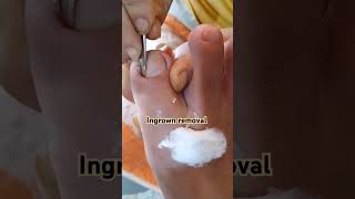 satisfying and relaxing pedicure pedicure relaxing satisfying nailcare [upl. by Twelve256]