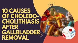 10 Causes Of Choledocholithiasis After Gallbladder Removal [upl. by Shiff382]