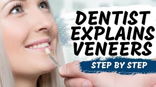 Porcelain Veneers Procedure Explained [upl. by Aprilette]