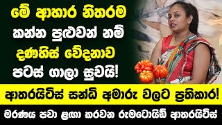 මේ ආහාර නිතරම කන්න පුළුවන් නම් දණහිස් වේදනාව පටස් ගාලා සුවයි ආතරයිටිස් සන්ධි අමාරු වලට ප්‍රතිකාර [upl. by Suillenroc853]