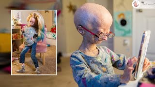 Adalia Rose Emotional Less Than 500 People in the World Have My Condition   Body Bizarre [upl. by Tterrag327]