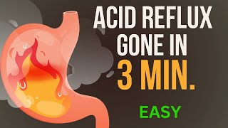 How to Get Rid of Acid Reflux PERMANENTLY with Betaine hydrochloride  Treat Acid Reflux Naturally [upl. by Tremayne]