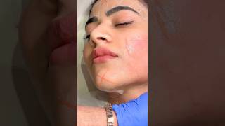 Get A Tightened Face Without Any Surgery  Sarayu Clinics hifu [upl. by Almeeta893]