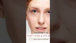 Puffy eyes treatment more information WhatsApp 9871054183  puffyeyes FacebookPage [upl. by Hawkins]