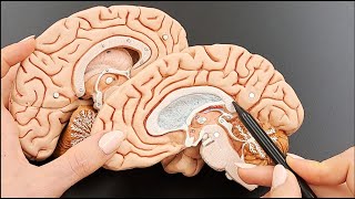 Brain Anatomy Cross Section Structures  MADE EASY  Part 3 of 5 [upl. by Capriola]