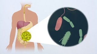 Antagonism toward the intestinal microbiota and its effect on Vibrio cholerae virulence [upl. by Denzil]