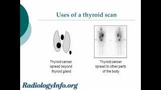 Your Radiologist Explains Thyroid Gland and Scan [upl. by Remos128]