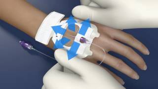 Tegaderm™ IV Advanced Dressing 1683 for PIV Application Video [upl. by Olemrac42]