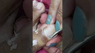 simple cleaning toenail satisfy client videos pedicure satisfying subscribe [upl. by Llenehs]