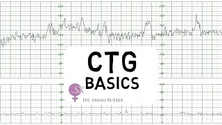 CTG Basics [upl. by Carhart336]