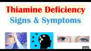 Vitamin B12 Deficiency Is adult and childs vitamineB12deficiency [upl. by Rahsab]