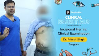 PrepLadder Clinical Essentials  Incisional Hernia Clinical Examination  Dr Pritesh Singh [upl. by Saxela]