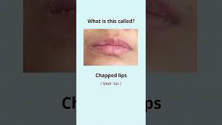 Can you name these common skin problems English Vocabulary Builder [upl. by Ardeahp]