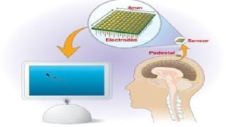 Seminar Report on Braingate [upl. by Wallack]