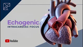 Echogenic Intracardiac Focus [upl. by Kaczer143]