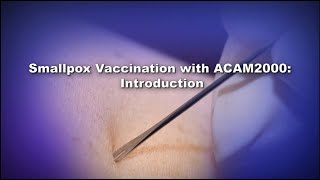 Chapter 1 Smallpox Vaccination with ACAM2000 Introduction [upl. by Natie]