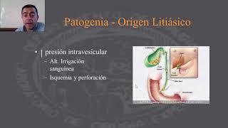 Patología de la Colecistitis Aguda [upl. by Einhoj134]