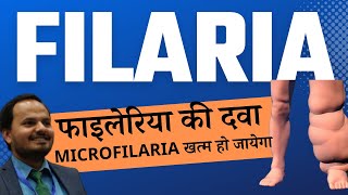 Filaria ki dawa Treatment of microfilaria Filariasis ka ilaaz Dr Pratyush Kumar [upl. by Ojaras]