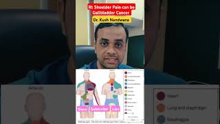 Why This Shoulder Pain Could Be Cancer ytshorts shorts [upl. by Infeld]