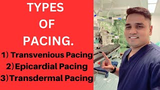 Types Of Pacing Transvenious PacingEpicardial PacingTransdermal Pacing [upl. by Mauve582]