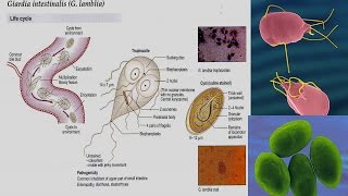 Giardia parasite causing human infections [upl. by Elinad933]