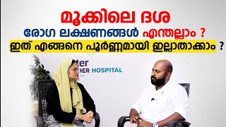 കുട്ടികളിലെ മൂക്കിൽ ദശ എങ്ങനെ പൂർണ്ണമായി ഇല്ലാതാക്കാം  Adenoids  Arogyam [upl. by Ahsatal]