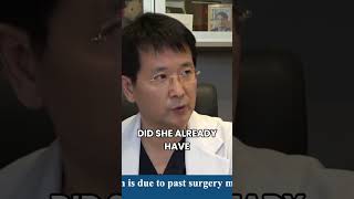 🔍 Fixing Botched Surgeries A Surgeons Perspective 🔍 shorts [upl. by Nnaer634]