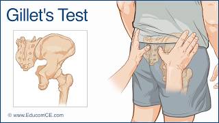 Gillets Test for Sacroiliac dysfunction  Chiropractic Online CE™ [upl. by Neveda192]