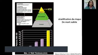 18Cardiomyopathies Pr Hammoudi  Cardio [upl. by Uhp]