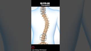 Scoliotic Spine Correction Short Video  spine shorts [upl. by Gael770]