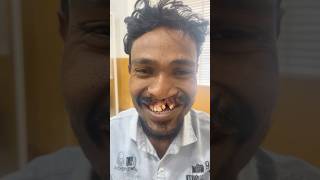 Rare deformity for a man cleft trending [upl. by Enilram285]