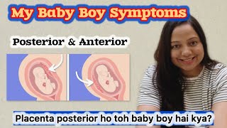 My Baby Boy Symptoms in pregnancy  Placenta Position se pata chalta hai baby ka gender [upl. by Aerona170]