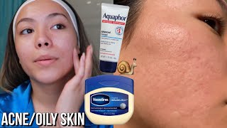 Viral Skincare Slugging using Vaseline and Aquaphor [upl. by Orenid]