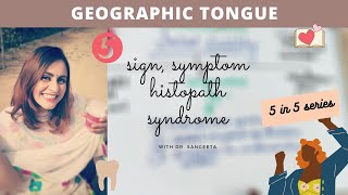 geographic tongue [upl. by Nabois]