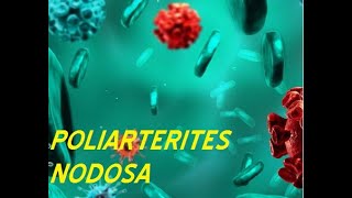 POLIARTERITIS NODOSA PATOLOGIA [upl. by Devonne]