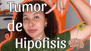 storytime tumor de hipÃ³fisis  La Eve ðŸ§¡ [upl. by Marcellina]