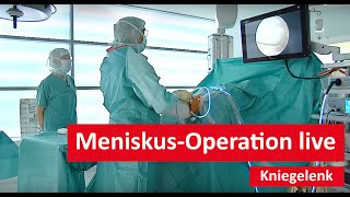 Kniegelenk MeniskusOperation live [upl. by Hart]